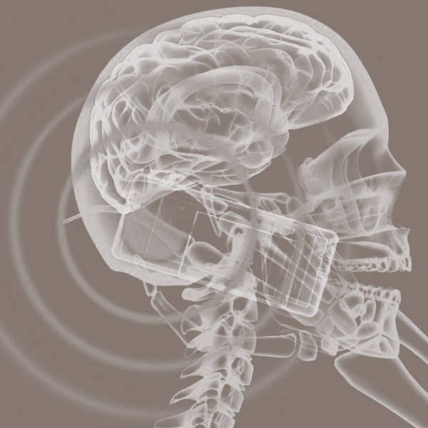 headphone xray